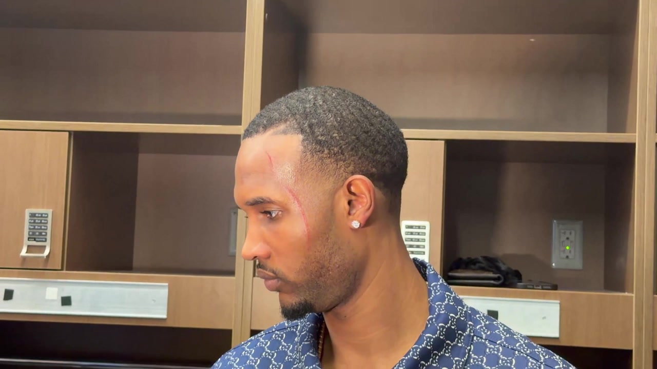 Evan Mobley came out of this one with a couple of pretty significant scratches on his face